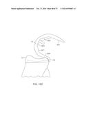 SYSTEMS AND METHODS FOR PROVIDING A FEMORAL COMPONENT diagram and image