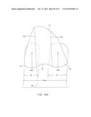 SYSTEMS AND METHODS FOR PROVIDING A FEMORAL COMPONENT diagram and image