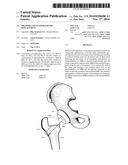 METHODS AND SYSTEMS FOR HIP REPLACEMENT diagram and image