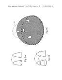 METHODS AND SYSTEMS FOR HIP REPLACEMENT diagram and image