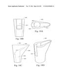 METHODS AND SYSTEMS FOR HIP REPLACEMENT diagram and image