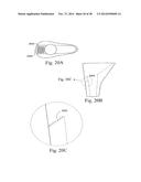 METHODS AND SYSTEMS FOR HIP REPLACEMENT diagram and image