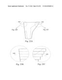 METHODS AND SYSTEMS FOR HIP REPLACEMENT diagram and image