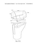 METHODS AND SYSTEMS FOR HIP REPLACEMENT diagram and image