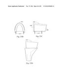 METHODS AND SYSTEMS FOR HIP REPLACEMENT diagram and image