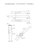 METHODS AND SYSTEMS FOR HIP REPLACEMENT diagram and image