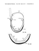 HEADGEAR ACCESSORY ATTACHMENT APPARATUS diagram and image