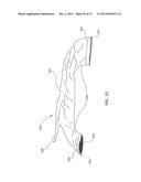 Patient Support with Air Bladder Control Sensitive to An Orientation Angle     Sensor diagram and image