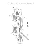 Method of Knitting a Knitted Component for an Article of Footwear diagram and image