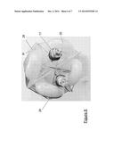 Insect Killing Apparatus and Method of Construction diagram and image