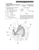 DEVICE FOR SECURING A HORSE-RIDING SADDLE ONTO A HORSE diagram and image