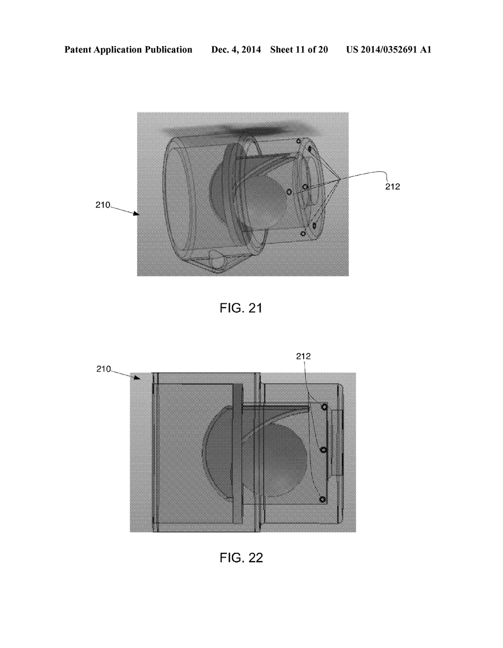 ADJUSTABLE AND BIASED-OPEN UNIDIRECTIONAL SPEAKING VALVE - diagram, schematic, and image 12