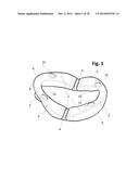 INCREMENTAL AND/OR SUCCESSIVE ADJUSTABLE MANDIBULAR ADVANCEMENT DEVICE FOR     PREVENTING AND TREATMENT OF SNORING AND OBSTRUCTIVE SLEEP APNEA diagram and image