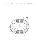 INCREMENTAL AND/OR SUCCESSIVE ADJUSTABLE MANDIBULAR ADVANCEMENT DEVICE FOR     PREVENTING AND TREATMENT OF SNORING AND OBSTRUCTIVE SLEEP APNEA diagram and image