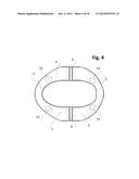 INCREMENTAL AND/OR SUCCESSIVE ADJUSTABLE MANDIBULAR ADVANCEMENT DEVICE FOR     PREVENTING AND TREATMENT OF SNORING AND OBSTRUCTIVE SLEEP APNEA diagram and image