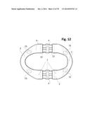 INCREMENTAL AND/OR SUCCESSIVE ADJUSTABLE MANDIBULAR ADVANCEMENT DEVICE FOR     PREVENTING AND TREATMENT OF SNORING AND OBSTRUCTIVE SLEEP APNEA diagram and image