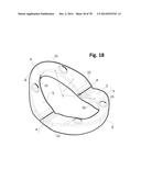 INCREMENTAL AND/OR SUCCESSIVE ADJUSTABLE MANDIBULAR ADVANCEMENT DEVICE FOR     PREVENTING AND TREATMENT OF SNORING AND OBSTRUCTIVE SLEEP APNEA diagram and image