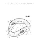 INCREMENTAL AND/OR SUCCESSIVE ADJUSTABLE MANDIBULAR ADVANCEMENT DEVICE FOR     PREVENTING AND TREATMENT OF SNORING AND OBSTRUCTIVE SLEEP APNEA diagram and image