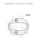 INCREMENTAL AND/OR SUCCESSIVE ADJUSTABLE MANDIBULAR ADVANCEMENT DEVICE FOR     PREVENTING AND TREATMENT OF SNORING AND OBSTRUCTIVE SLEEP APNEA diagram and image