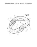 INCREMENTAL AND/OR SUCCESSIVE ADJUSTABLE MANDIBULAR ADVANCEMENT DEVICE FOR     PREVENTING AND TREATMENT OF SNORING AND OBSTRUCTIVE SLEEP APNEA diagram and image