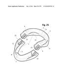 INCREMENTAL AND/OR SUCCESSIVE ADJUSTABLE MANDIBULAR ADVANCEMENT DEVICE FOR     PREVENTING AND TREATMENT OF SNORING AND OBSTRUCTIVE SLEEP APNEA diagram and image