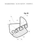 INCREMENTAL AND/OR SUCCESSIVE ADJUSTABLE MANDIBULAR ADVANCEMENT DEVICE FOR     PREVENTING AND TREATMENT OF SNORING AND OBSTRUCTIVE SLEEP APNEA diagram and image