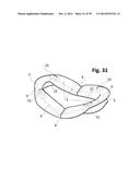 INCREMENTAL AND/OR SUCCESSIVE ADJUSTABLE MANDIBULAR ADVANCEMENT DEVICE FOR     PREVENTING AND TREATMENT OF SNORING AND OBSTRUCTIVE SLEEP APNEA diagram and image