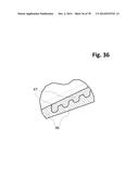 INCREMENTAL AND/OR SUCCESSIVE ADJUSTABLE MANDIBULAR ADVANCEMENT DEVICE FOR     PREVENTING AND TREATMENT OF SNORING AND OBSTRUCTIVE SLEEP APNEA diagram and image