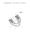 INCREMENTAL AND/OR SUCCESSIVE ADJUSTABLE MANDIBULAR ADVANCEMENT DEVICE FOR     PREVENTING AND TREATMENT OF SNORING AND OBSTRUCTIVE SLEEP APNEA diagram and image