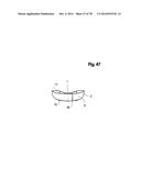 INCREMENTAL AND/OR SUCCESSIVE ADJUSTABLE MANDIBULAR ADVANCEMENT DEVICE FOR     PREVENTING AND TREATMENT OF SNORING AND OBSTRUCTIVE SLEEP APNEA diagram and image