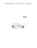 INCREMENTAL AND/OR SUCCESSIVE ADJUSTABLE MANDIBULAR ADVANCEMENT DEVICE FOR     PREVENTING AND TREATMENT OF SNORING AND OBSTRUCTIVE SLEEP APNEA diagram and image