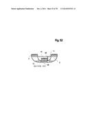 INCREMENTAL AND/OR SUCCESSIVE ADJUSTABLE MANDIBULAR ADVANCEMENT DEVICE FOR     PREVENTING AND TREATMENT OF SNORING AND OBSTRUCTIVE SLEEP APNEA diagram and image