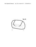 INCREMENTAL AND/OR SUCCESSIVE ADJUSTABLE MANDIBULAR ADVANCEMENT DEVICE FOR     PREVENTING AND TREATMENT OF SNORING AND OBSTRUCTIVE SLEEP APNEA diagram and image