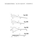 INCREMENTAL AND/OR SUCCESSIVE ADJUSTABLE MANDIBULAR ADVANCEMENT DEVICE FOR     PREVENTING AND TREATMENT OF SNORING AND OBSTRUCTIVE SLEEP APNEA diagram and image