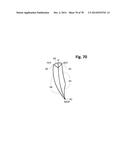 INCREMENTAL AND/OR SUCCESSIVE ADJUSTABLE MANDIBULAR ADVANCEMENT DEVICE FOR     PREVENTING AND TREATMENT OF SNORING AND OBSTRUCTIVE SLEEP APNEA diagram and image