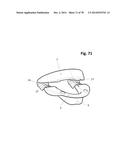 INCREMENTAL AND/OR SUCCESSIVE ADJUSTABLE MANDIBULAR ADVANCEMENT DEVICE FOR     PREVENTING AND TREATMENT OF SNORING AND OBSTRUCTIVE SLEEP APNEA diagram and image