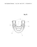 INCREMENTAL AND/OR SUCCESSIVE ADJUSTABLE MANDIBULAR ADVANCEMENT DEVICE FOR     PREVENTING AND TREATMENT OF SNORING AND OBSTRUCTIVE SLEEP APNEA diagram and image