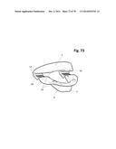 INCREMENTAL AND/OR SUCCESSIVE ADJUSTABLE MANDIBULAR ADVANCEMENT DEVICE FOR     PREVENTING AND TREATMENT OF SNORING AND OBSTRUCTIVE SLEEP APNEA diagram and image