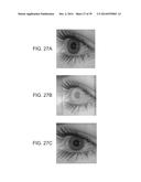 FRONTAL VIEW RECONSTRUCTION FOR IRIS RECOGNITION diagram and image