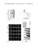 PLOD2 as a Target of Intervention for Sarcoma Metastasis diagram and image