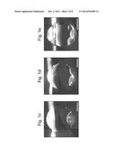 Multisomes:  Encapsulated Droplet Networks diagram and image