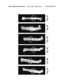 BMP-1 Procollagen C-Proteinase for Diagnosis and Treatment of Bone and     Soft Tissue Defects and Disorders diagram and image