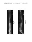 BMP-1 Procollagen C-Proteinase for Diagnosis and Treatment of Bone and     Soft Tissue Defects and Disorders diagram and image