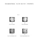 PHARMACEUTICAL COMPOSITIONS OF     7-(6-(2-HYDROXYPROPAN-2-YL)PYRIDIN-3-YL)-1-((TRANS)-4-METHOXYCYCLOHEXYL)--    3,4-DIHYDROPYRAZINO [2,3-B]PYRAZIN-2(1H)-ONE, A SOLID FORM THEREOF AND     METHODS OF THEIR USE diagram and image