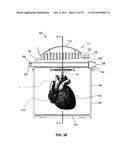 APPARATUS FOR OXYGENATION AND PERFUSION OF TISSUE FOR ORGAN PRESERVATION diagram and image