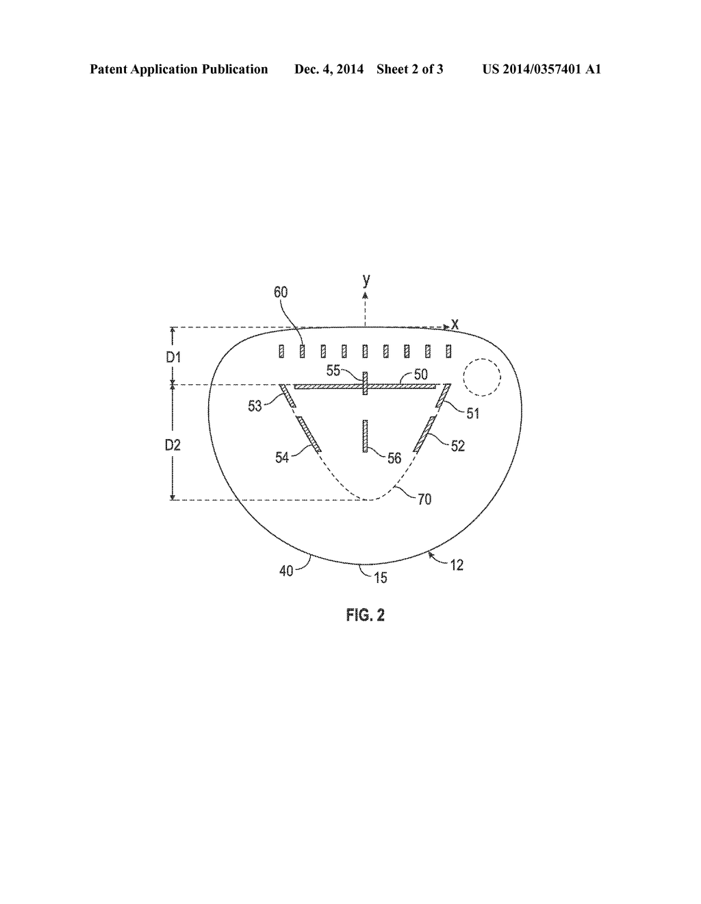 GOLF CLUB HEAD WITH SLOTS - diagram, schematic, and image 03