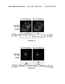 NOVEL INHIBITORS OF NOX1 diagram and image