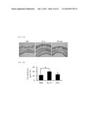 NOVEL PHYTOSPHINGOSINE DERIVATIVES, AND A COSMETIC COMPOSITION COMPRISING     THE SAME FOR PREVENTING AND AMELIORATING INFLAMMATORY SKIN DISEASES AND     HYPERKERATOSIS DISEASES diagram and image