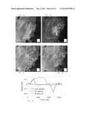 NON-BLOOD CONTACTING MECHANICAL DEVICE THAT IMPROVES HEART FUNCTION AFTER     INJURY diagram and image