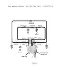 NON-BLOOD CONTACTING MECHANICAL DEVICE THAT IMPROVES HEART FUNCTION AFTER     INJURY diagram and image